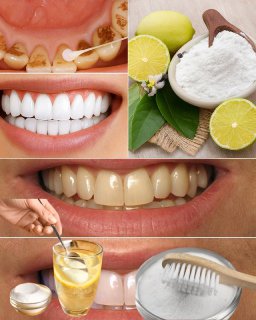 🍋 Rețetă Naturală cu Bicarbonat și Lămâie pentru Curățarea și Albirea Dinților!