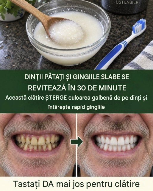 Nu mai risipi bani pe metode dure de albire a dinților acasă
